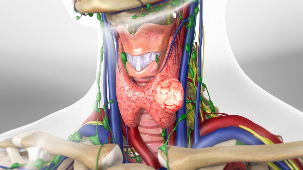 thyroidnodule_1280-1200x675.jpg