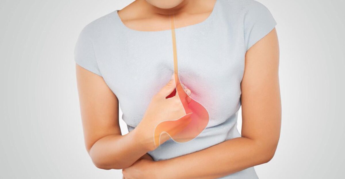 Reflusso gastroesofageo – Chirurgia Laparoscopica